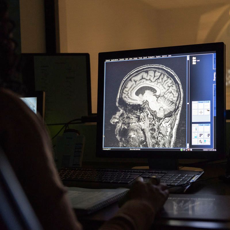 A computer monitor displaying a detailed MRI brain scan while an operator reviews the imaging data in a control room.