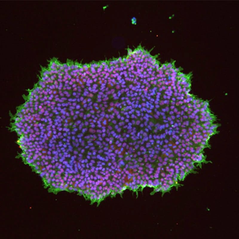 A fluorescent microscopy image showing a large cluster of cells with bright purple centers and green outlines against a dark background.