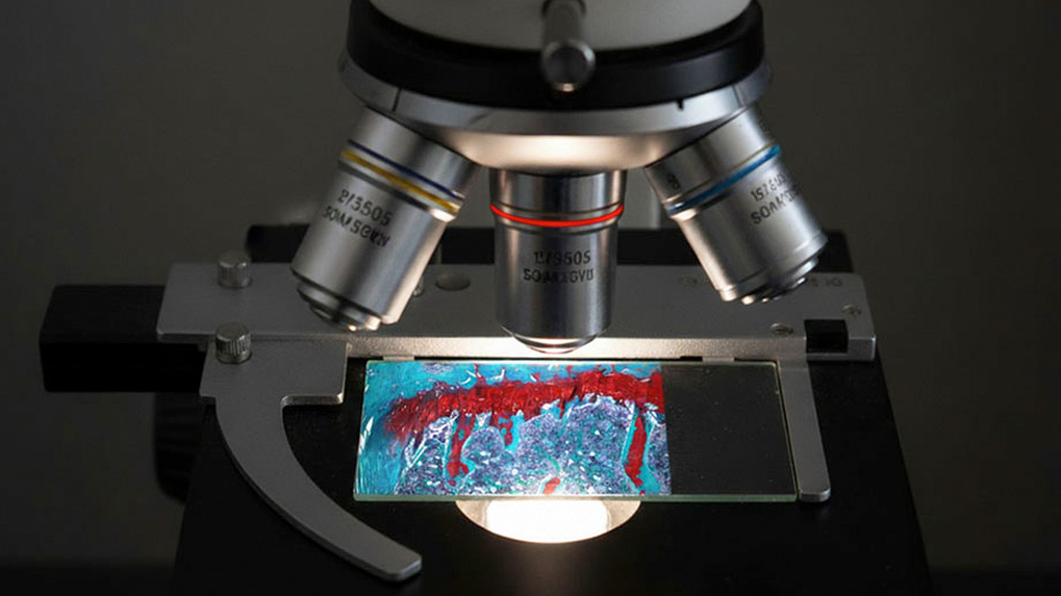 A stained tissue sample on a microscope slide viewed under a compound microscope with multiple objective lenses.